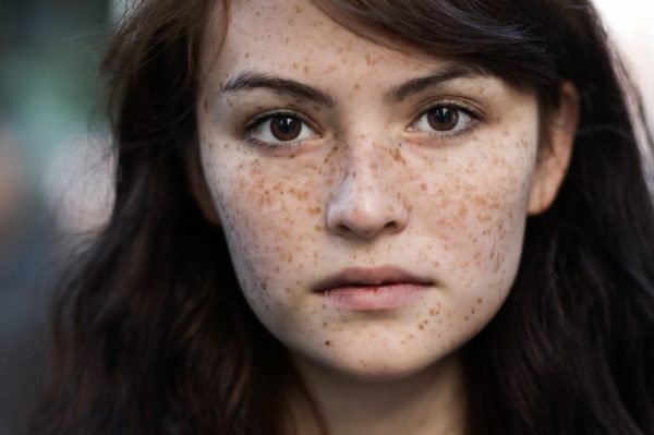 Приснились веснушки на лице - что это значит?